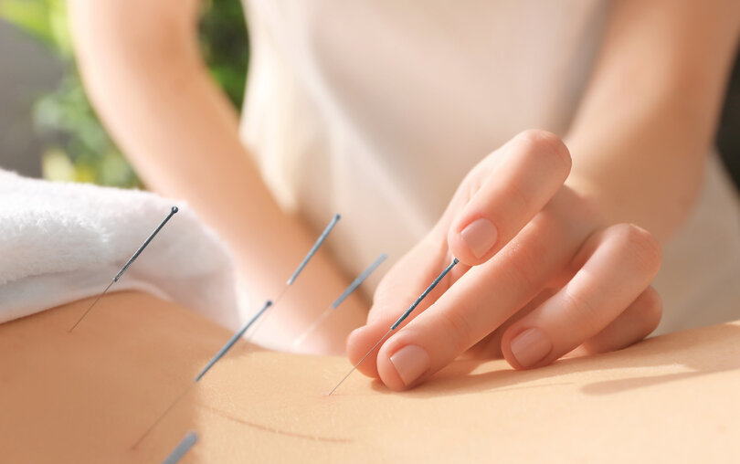 Akupunktur & TCM in Pratteln inkl. Tui Na Massage, Schr&ouml;pfen & Gua Sha.Traditionelle Chinesische Medizin mit ganzheitlichem Ansatz, individuell abgestimmt.
